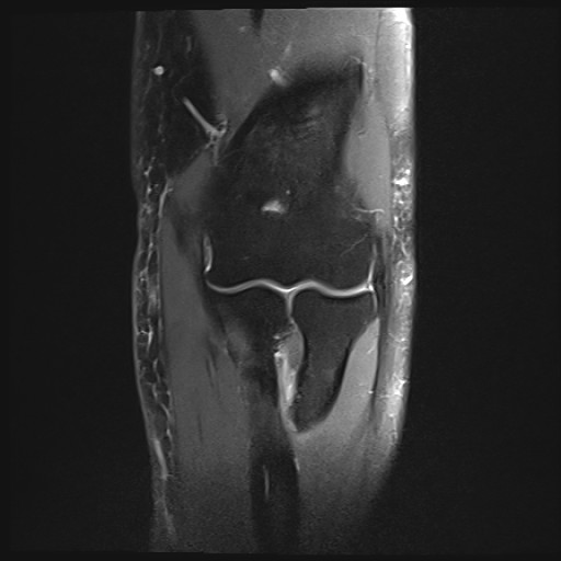 Click on the Serie image to view the images of Wieszt, Gnter